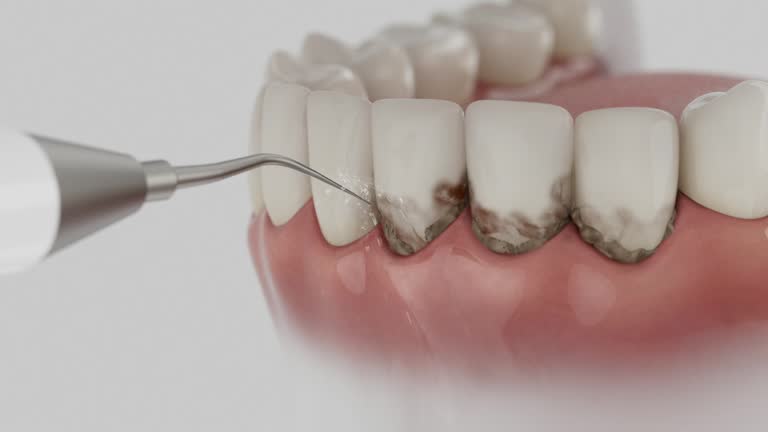 Trusted Dental Implants service in Kiefer, OK - Dentist Open Now